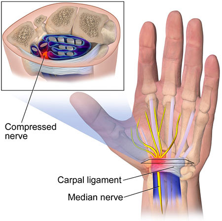 Fixing Boxing Wrist Pain: Tips, Treatment, and Prevention