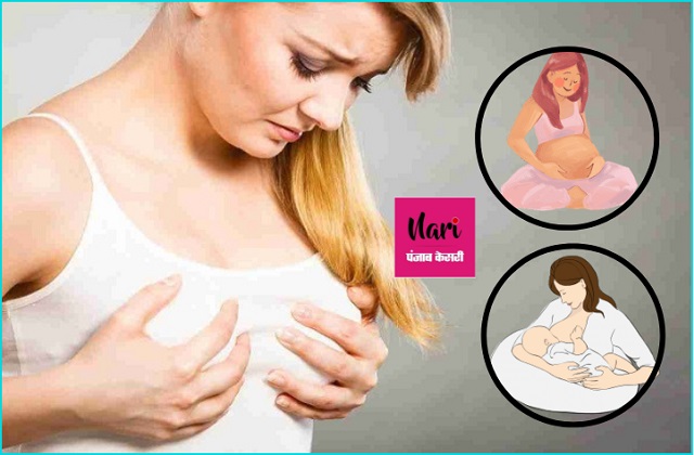 इंडियन निप्पल बाइट: यह क्यों होता है और इसे कैसे रोकें?