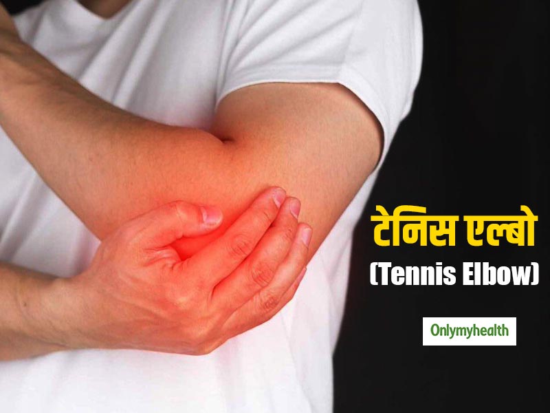 टेनिस एल्बो होने पर भी टेनिस कैसे खेलें? (जल्दी ठीक होने के 3 तरीके)